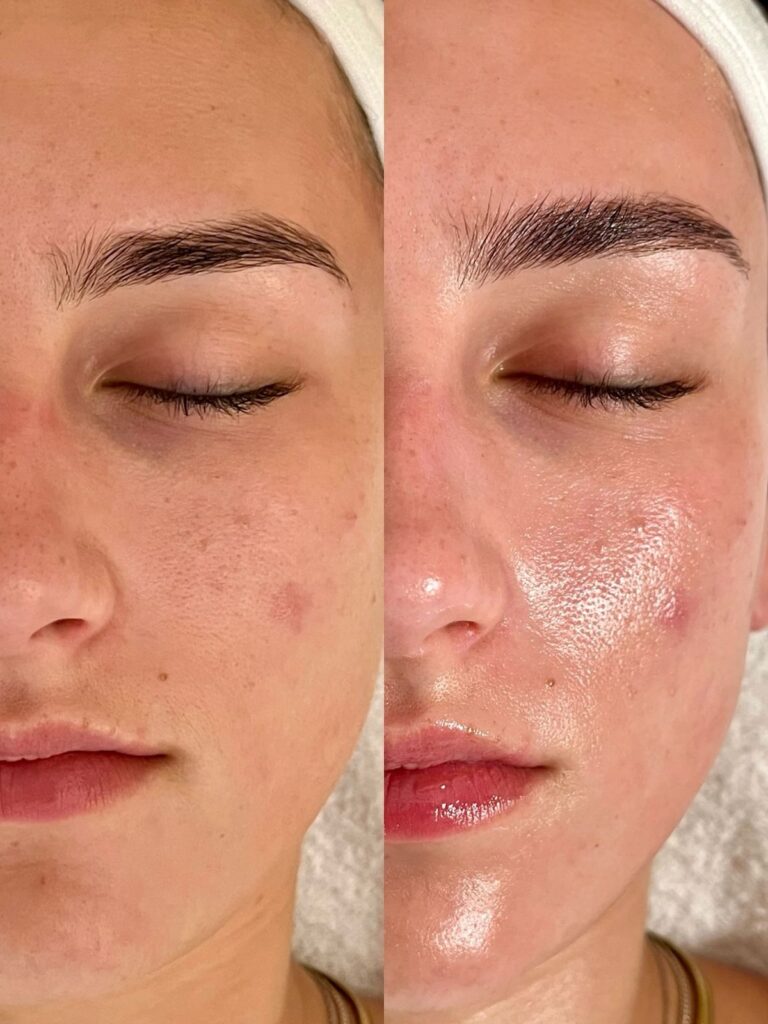 Facial Treatment